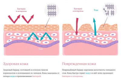 Раздражение.jpg