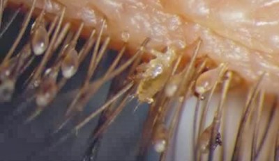 302-Eyelash-Mites.jpg